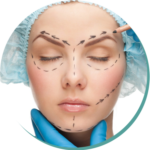chirurgia del volto